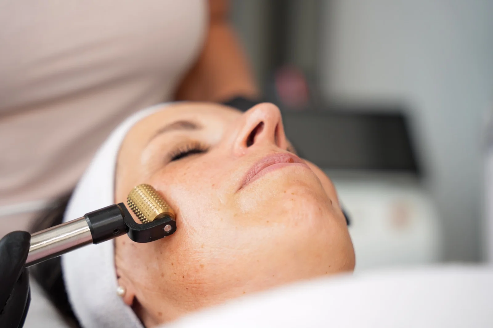 Erlebnispaket Microneedling